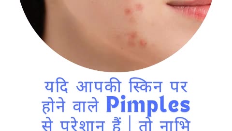 अगर आप भी Pimples से परेशान हैं #viral #like #follow #trending