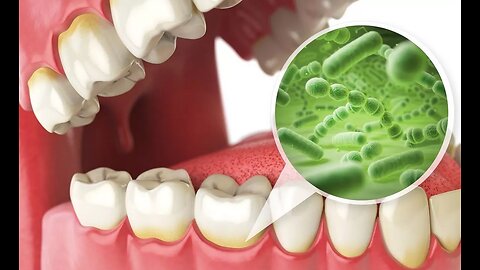 New probiotics for restoring, preserving and boosting your oral health