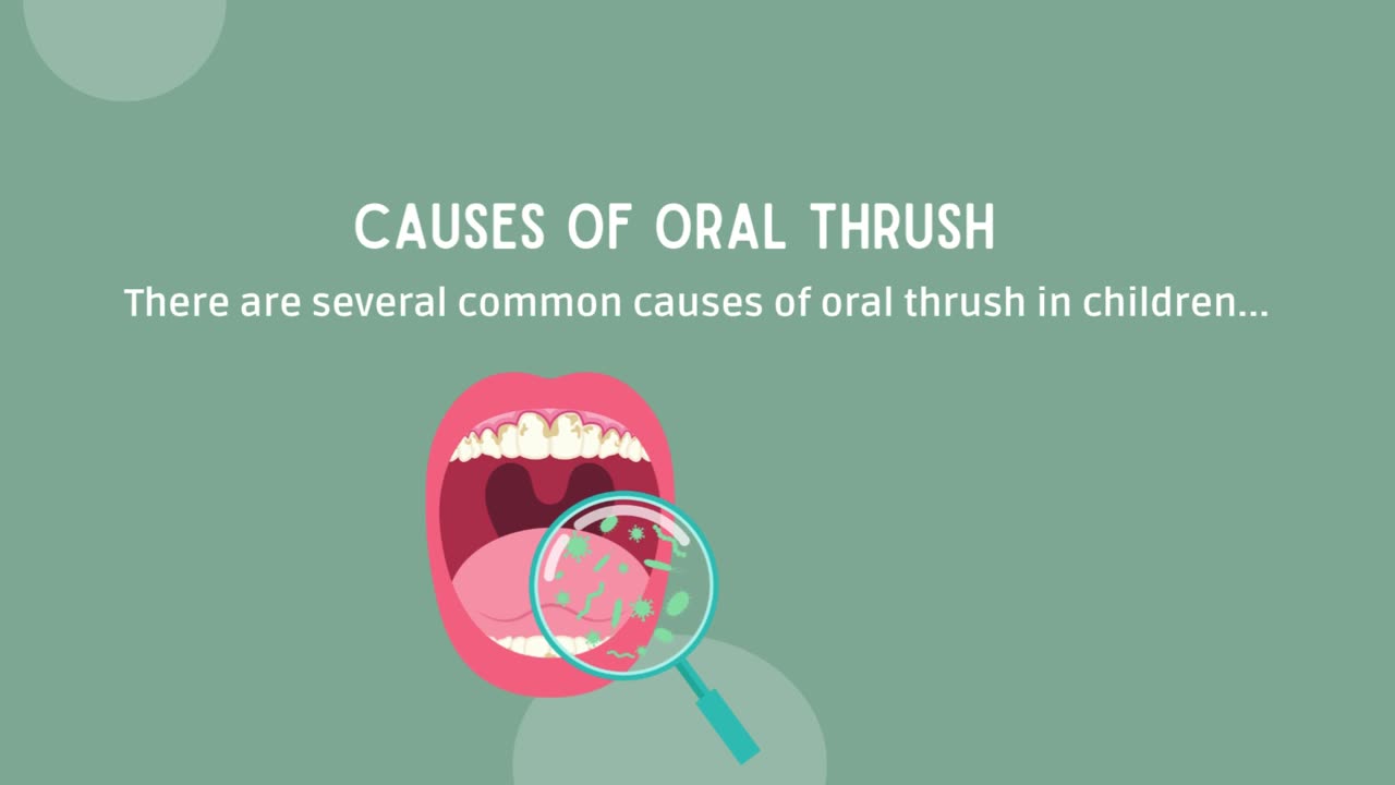 Causes and At-Home Remedies for Oral Thrush in Children