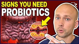 Probiotic Benefits | Top Signs You Should Be Taking A Probiotic