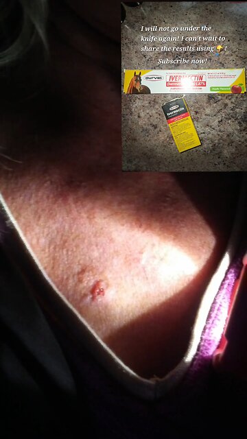 I will not go under the knife again with ivermectin.