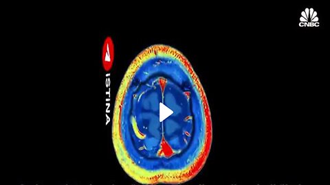 Graphene Brain interface🧠🤯