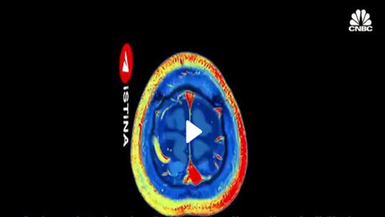 Graphene Brain interface🧠🤯
