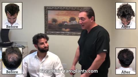 Patient Lionel’s MaxHarvest™ Plus Hair Transplant Journey with Dr. Brett Bolton