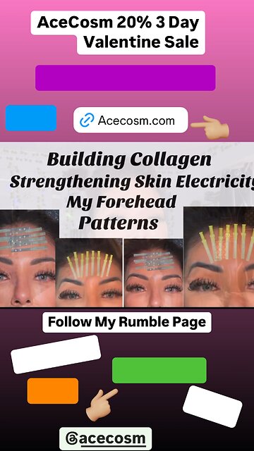 Temple enhancement as we age, we begin to lose Volume