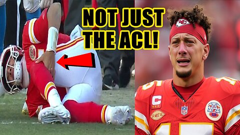 Patrick Mahomes gets BAD NEWS during ACL surgery! Done for 2026?