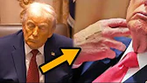 Trump’s appearance changing fast, doctors are noticing