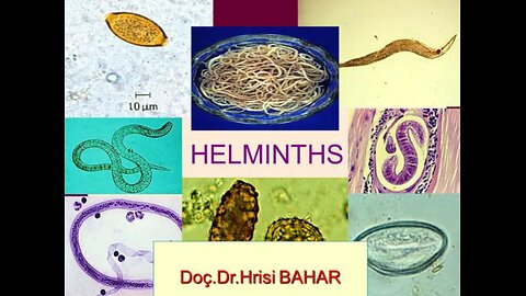 Helminths a.k.a. Parasites (UPDATED - OFFICIAL VIDEO - MODIFIED CORRECT VERSION)