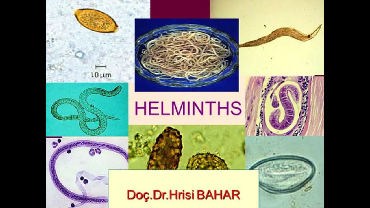 Helminths a.k.a. Parasites (UPDATED - OFFICIAL VIDEO - MODIFIED CORRECT VERSION)