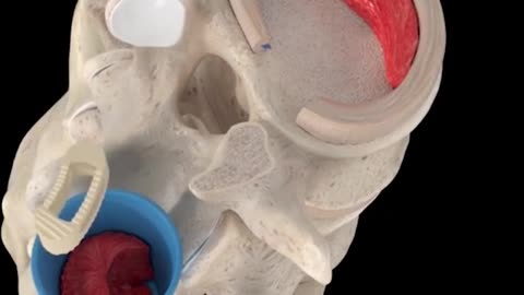 Lumbar Interbidy Fusion 3D Animation