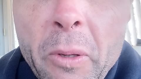 "White privilege" 🤔