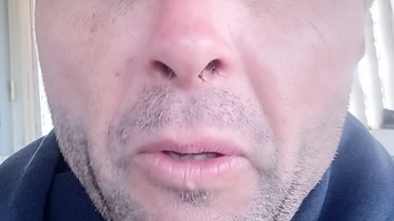 "White privilege" 🤔