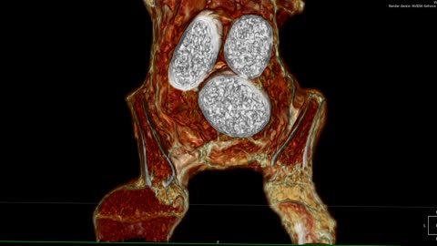 🤰🔬 The Internal Structure of a Pregnant 60cm Abdomen | TheTruthAbove
