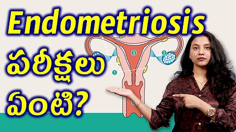 ఎండోమెట్రియోసిస్ పరీక్షలు ఏంటి? Tests and Investigations for Endometriosis Treatment | హోమియోపతి