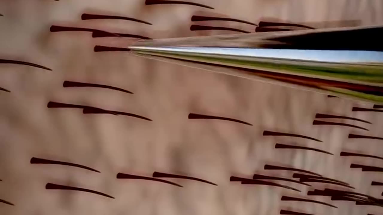 How Hair Transplants Work 🤨 #physics #science