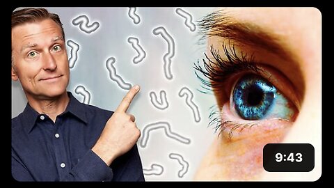 What Causes Eye Floaters and Dry Eyes?