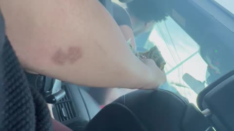 Lighting Fireworks Inside Vehicle Doesn't Go as Planned