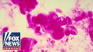 BREAKTHROUGH?: How breast cancer could be spotted earlier than ever