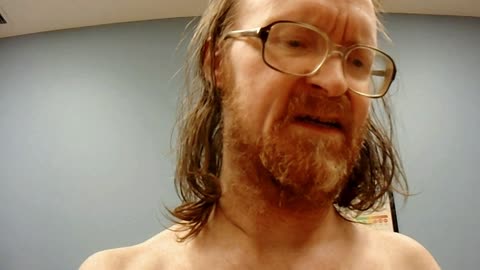 MICKMOCAM 28 _ THE MERRY MEDICAL MISHAPS of MICKMO! [NOT from 2023! LOL!] _ #mickmocam