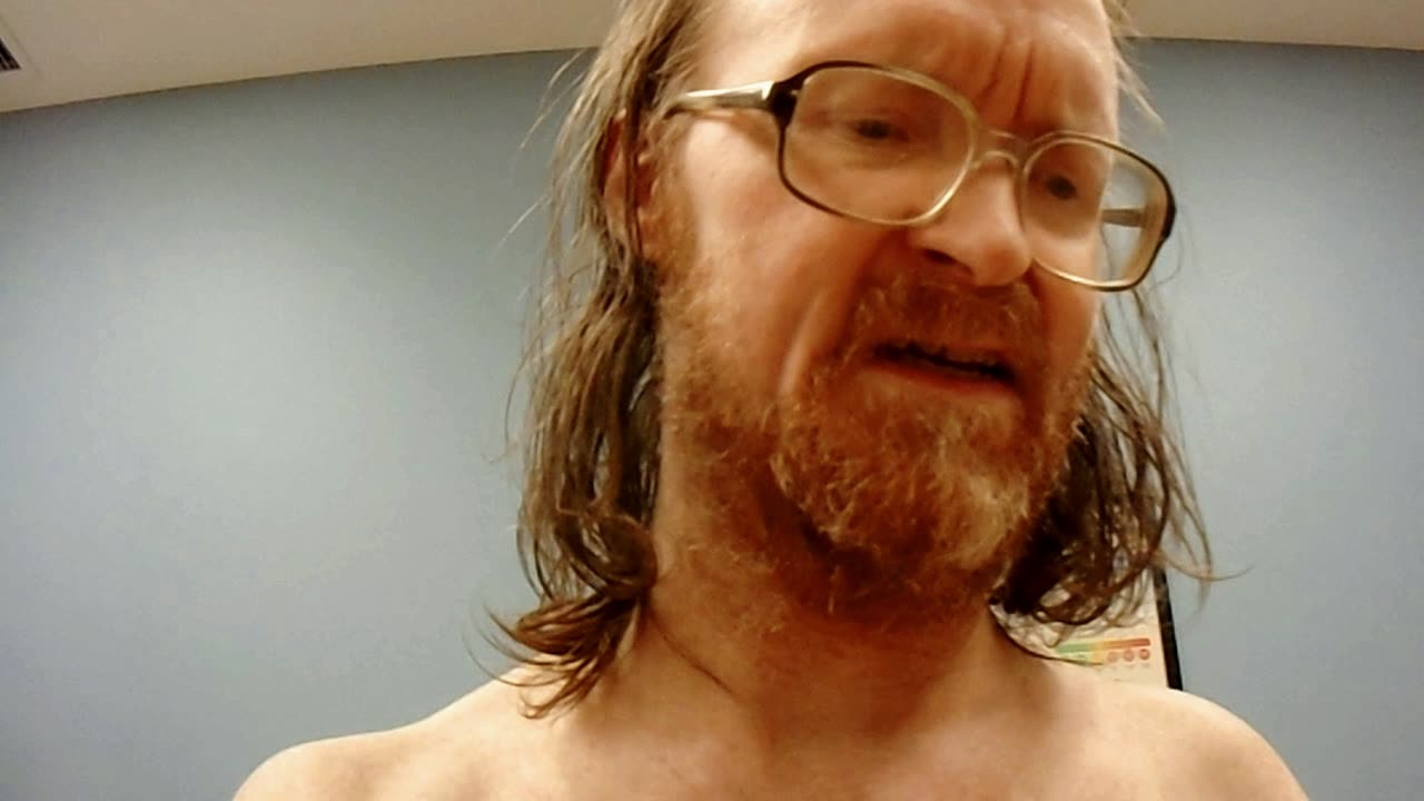 MICKMOCAM 28 _ THE MERRY MEDICAL MISHAPS of MICKMO! [NOT from 2023! LOL!] _ #mickmocam