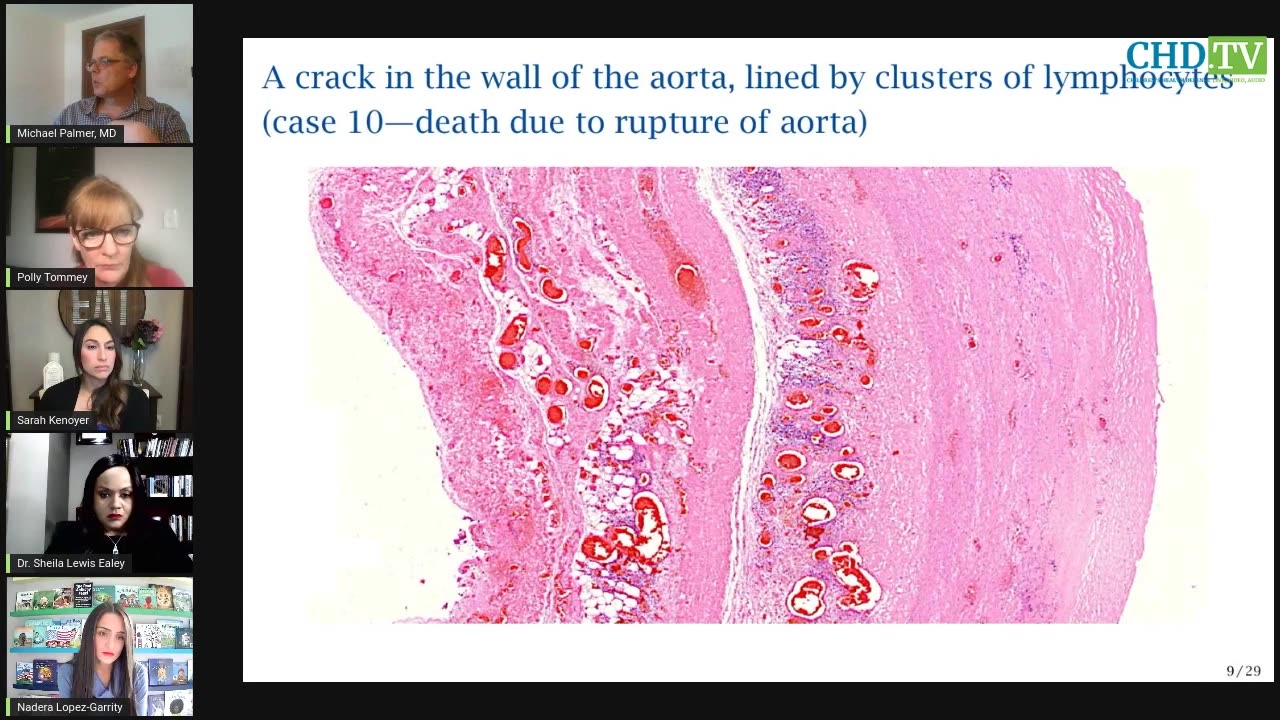 Covid Vaccines Evidence of Persistent Inflammation + Death in Autopsies — Michael Palmer, MD