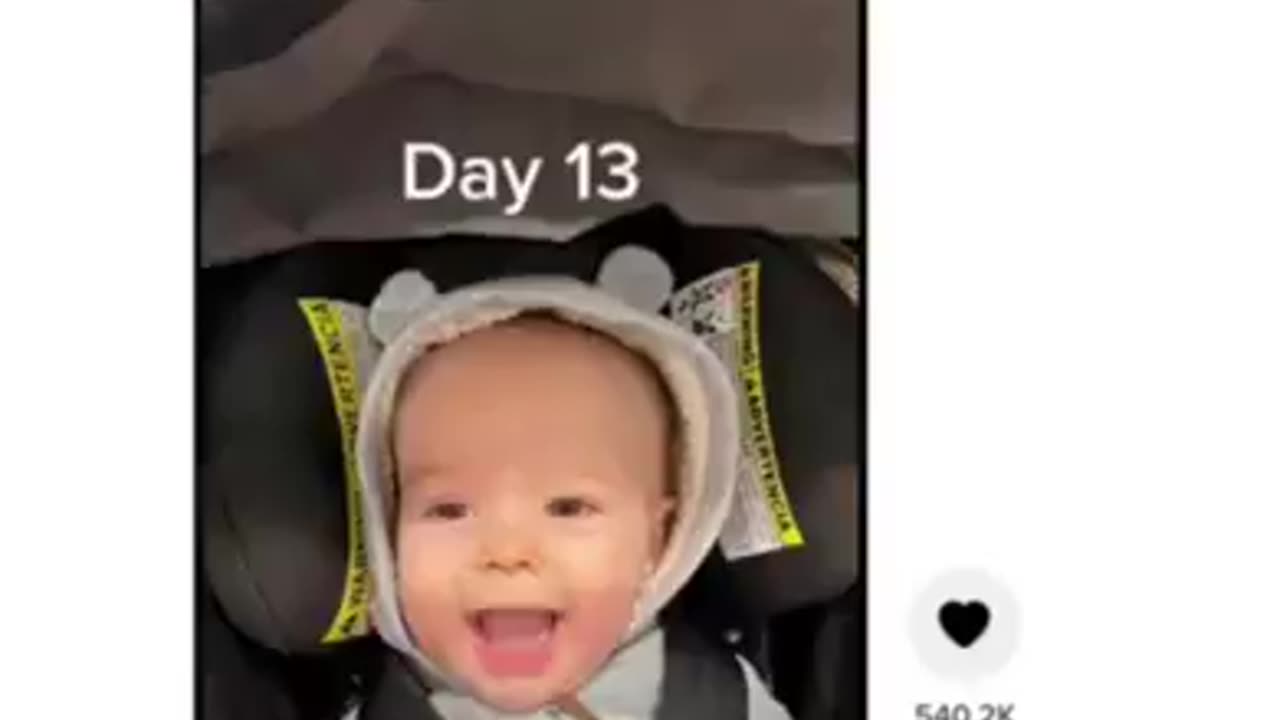 This is Nash Grim He was Paralyzed from the dTAP Vaccine from his 6 Month Wellness Checkup