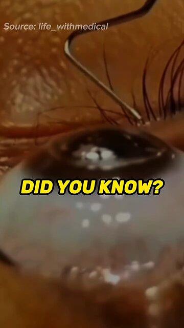 Seeing Things Differently 👁