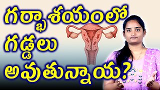 గర్భాశయంలో గడ్డలు అవుతున్నాయ? Risk Factors,Treatment & Investigations For Adinomayosis Homeopath