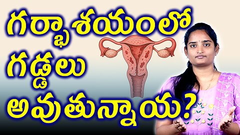 గర్భాశయంలో గడ్డలు అవుతున్నాయ? Risk Factors,Treatment & Investigations For Adinomayosis Homeopath