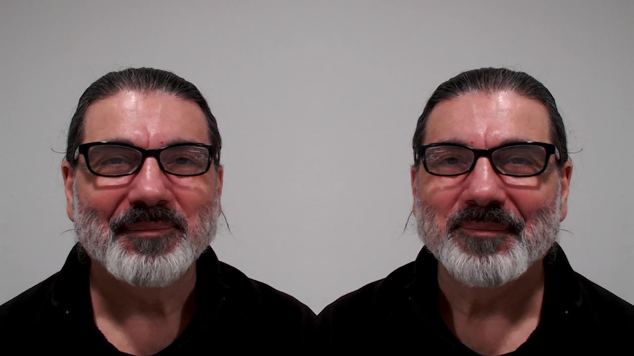Bet On It! Food For Thought - 44 - Mindfulness Is Radical Self-Acceptance