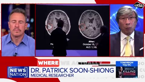 Human brain tumor literally melting away in months.