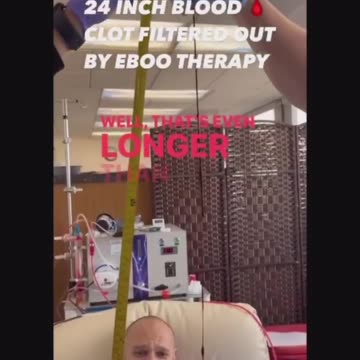 Blood Clots Found In Unvaxxed