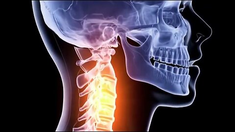 Reverse Arthritis and Pain Naturally