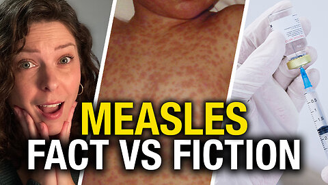 Measles or vaccine shedding? The real story behind sensationalist headlines