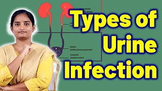 Know UTI Types & It's Treatments | Urinary Problem Cure Medicine Surgery | Gynaecology Women Female