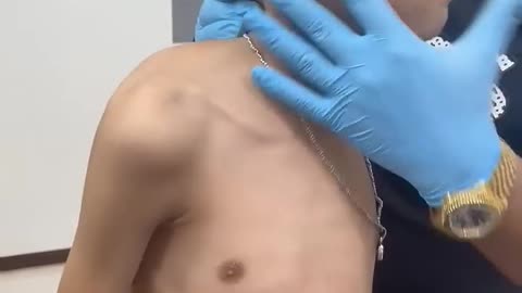 Scoliosis treatment