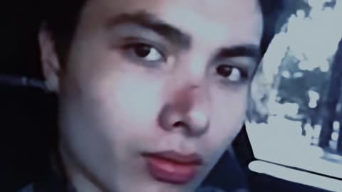 ER edit