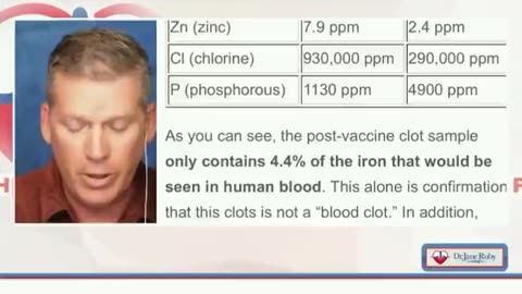 Scientist Mike Adams goes over his FINDINGS of what is in the WHITE CLOTS from the 💉