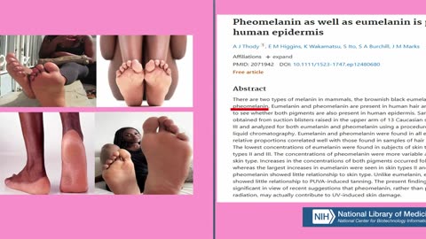 Pheomelanin can be seen on the bottom of your feet