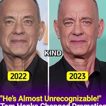 HOW DO CELEBRITIES STAY YOUNG?