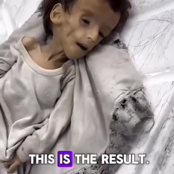 A tutti quelli che negano il genocidio a Gaza diciamo solo questo: VERGOGNATEVI!