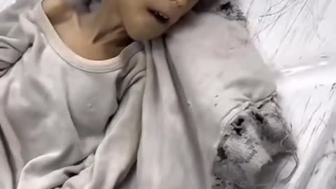 A tutti quelli che negano il genocidio a Gaza diciamo solo questo: VERGOGNATEVI!