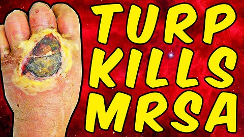 [Aug 26, 2022] Turpentine Kills MRSA (Scientifically Proven) [Sun Fruit Dan]