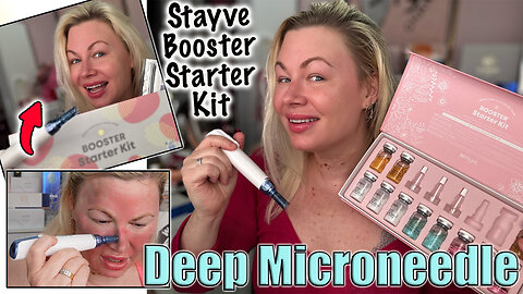 Deep Microneedle with the Stayve Skin Booster Kit! AceCosm.com and code Jessica10 Saves