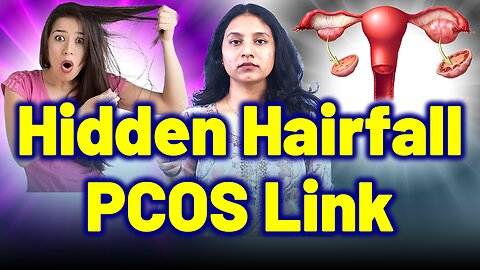 Unmasking the Link Between PCOS and Hair Fall, Scalp Hair Loss. | Treatment & Cure | Homeopathy,