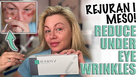 Rejuran I Meso, Reduce Under Eye Wrinkles without Toxin! AceCosm.com and code Jessica10 Saves