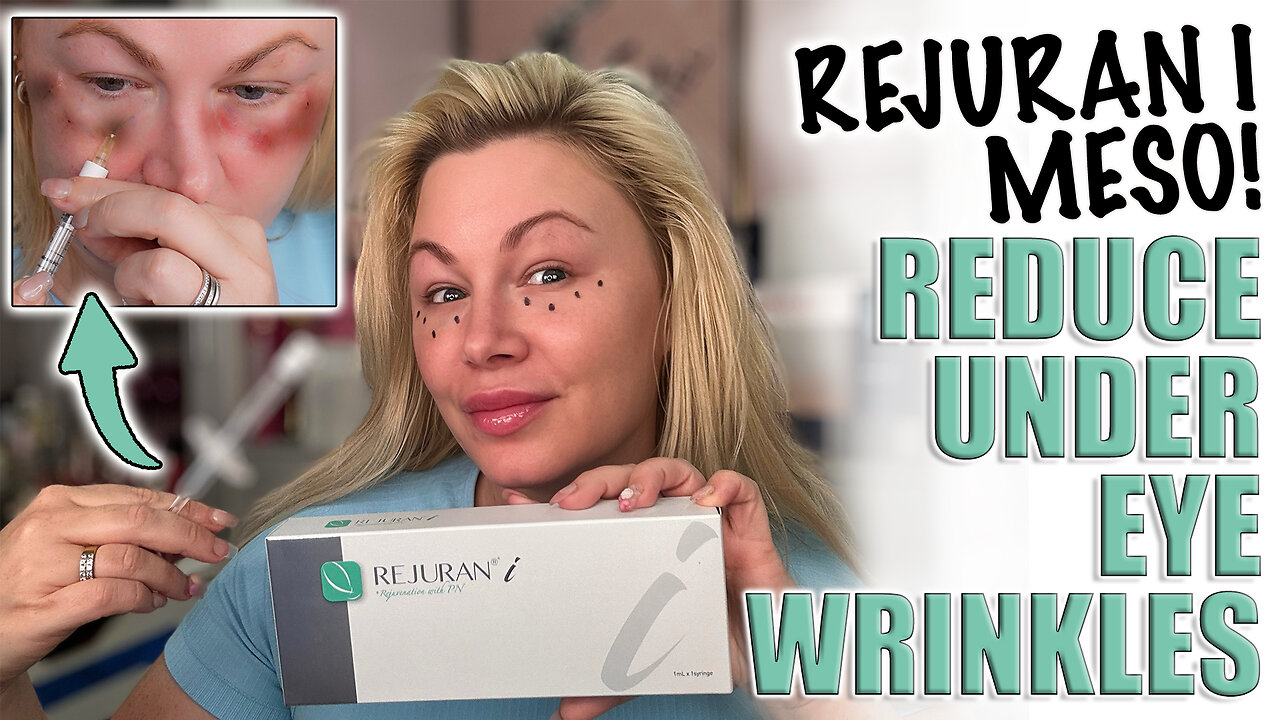 Rejuran I Meso, Reduce Under Eye Wrinkles without Toxin! AceCosm.com and code Jessica10 Saves