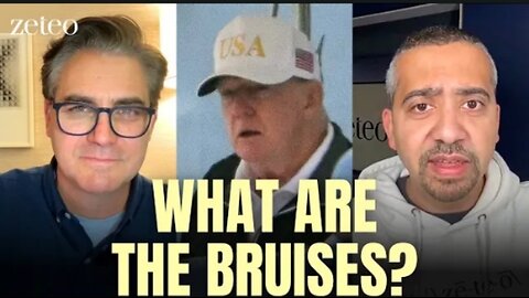 The Trump Health Cover-up - How Media Is COMPLICIT In a Huge Scandal