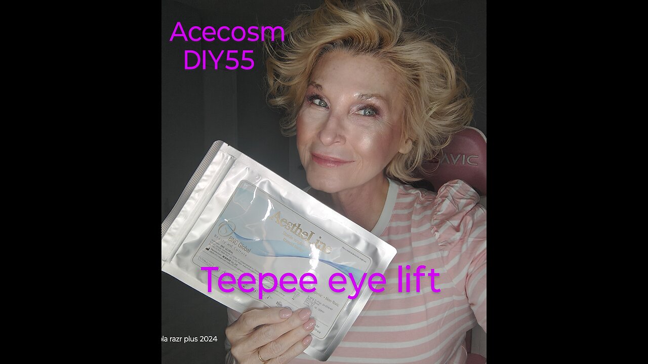 Teepee eye lift PDO threads Acecosm DIY55