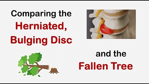 Comparing the Herniated Disc and the Fallen Tree